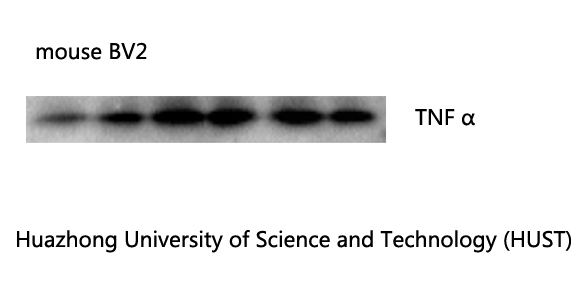 TNF α Monoclonal antibody(Q34) - Absci