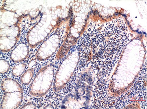 phospho-MLKL (S358) Mouse Monoclonal Antibody(6F8) - Absci