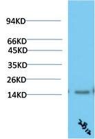 TTR Mouse Monoclonal Antibody(2B12) - Absci