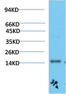 TTR Mouse Monoclonal Antibody(3F2)