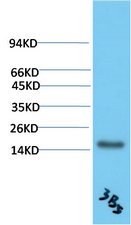 TTR Mouse Monoclonal Antibody(3B5) - Absci