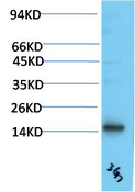 TTR Mouse Monoclonal Antibody(3G7)