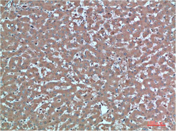 TTR Mouse Monoclonal Antibody(4A12)
