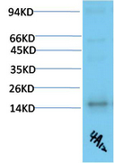 TTR Mouse Monoclonal Antibody(4A12)