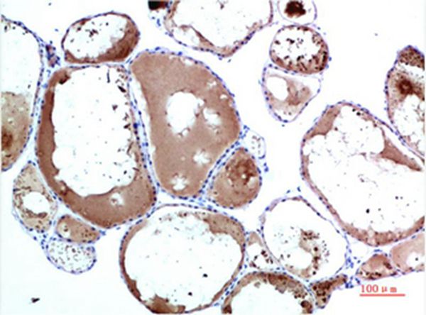 TTR Mouse Monoclonal Antibody(4E4) - Absci