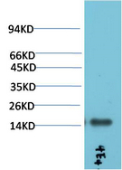 TTR Mouse Monoclonal Antibody(4E4)