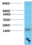 TTR Mouse Monoclonal Antibody(5G9)