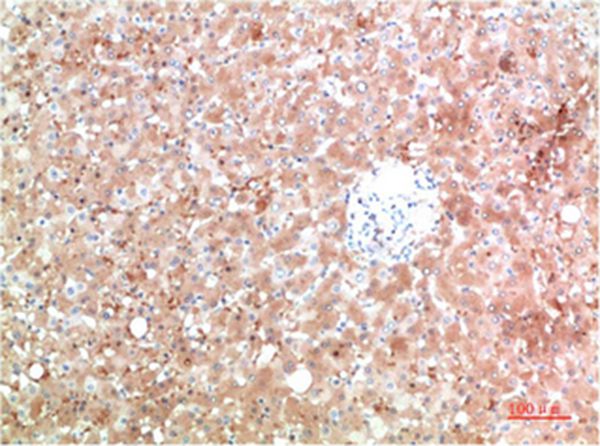 TTR Mouse Monoclonal Antibody(5A11)
