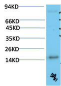 TTR Mouse Monoclonal Antibody(5A11)