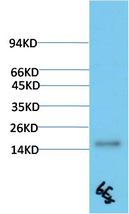TTR Mouse Monoclonal Antibody(6E5)