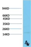 TTR Mouse Monoclonal Antibody(9A6)