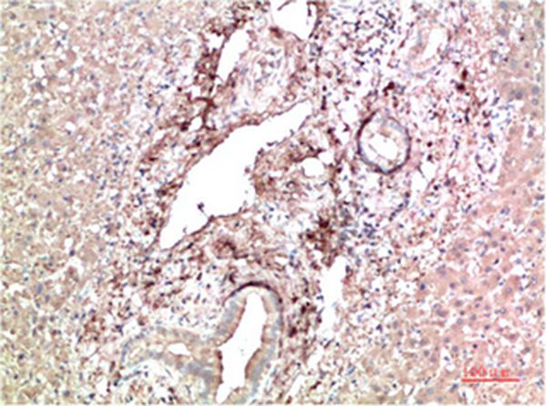 TTR Mouse Monoclonal Antibody(9D9) - Absci