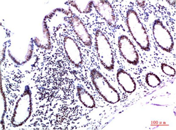 HP-1γ Mouse Monoclonal Antibody(3B9) - Absci