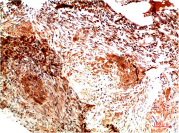 Collagen II Mouse Monoclonal Antibody(1H1) 
