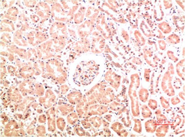 Collagen IV Mouse Monoclonal Antibody(8E5) - Absci