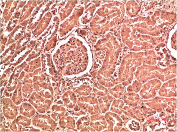 Collagen IV Mouse Monoclonal Antibody(5E10)