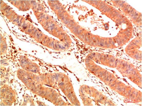 Acetyl P53(K382) Mouse Monoclonal Antibody(1G7) - Absci