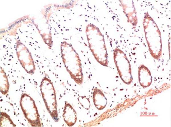 Collagen I Mouse Monoclonal Antibody(4B5)