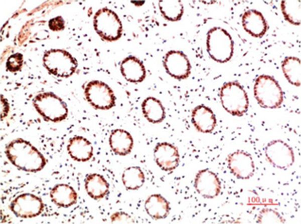 Collagen I Mouse Monoclonal Antibody(5B7)
