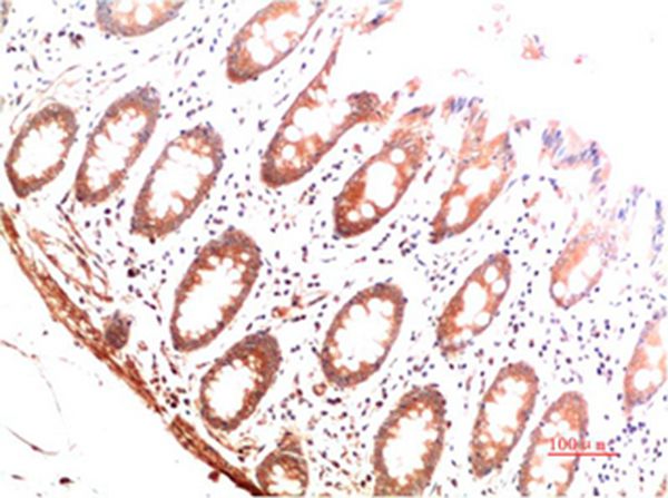Collagen I Mouse Monoclonal Antibody(6E11)