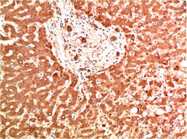 Collagen IV Mouse Monoclonal Antibody(5C9) - Absci