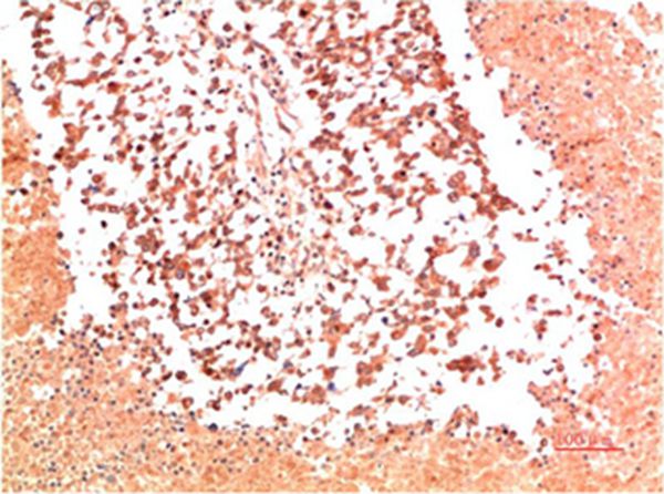 Collagen II Mouse Monoclonal Antibody(9C5) - Absci