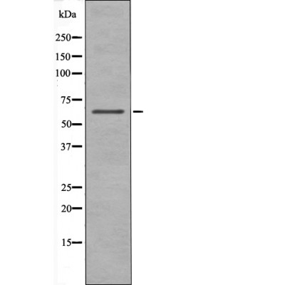 Chk2 (Phospho-Ser19) Antibody - Absci