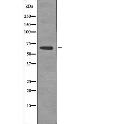 AFX1 (Phospho-Thr455) Antibody - Absci