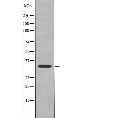 CDK1/CDC2 (Phospho-Thr161) Antibody - Absci