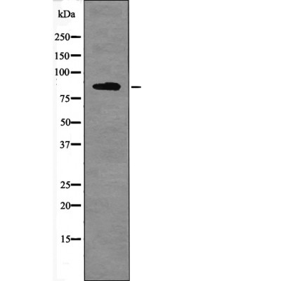 FER (Phospho-Tyr714) Antibody - Absci