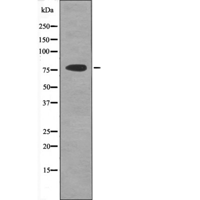 PKCT (Phospho-Tyr90) Antibody - Absci
