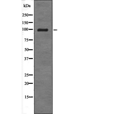 Androgen Receptor (Phospho-Tyr534) Antibody
