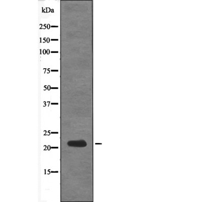 DSCR1 (Phospho-Ser108) Antibody