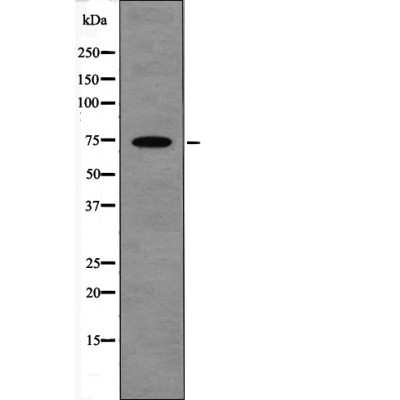 LIMK1 (Phospho-Ser310) Antibody - Absci