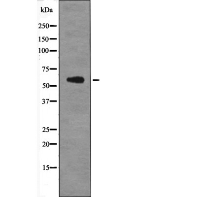 PFKFB2 (Phospho-Ser466) Antibody