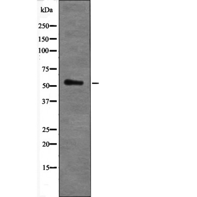 AKT1 (Phospho-Ser473+Tyr474) Antibody - Absci