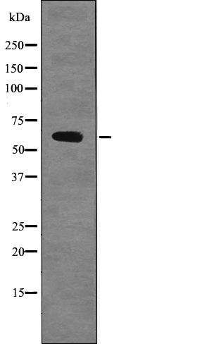 Chk2 (Phospho-Ser379) Antibody - Absci