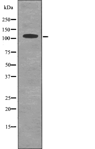 MYPT1/2 (Phospho-Ser668/Ser618) Antibody - Absci