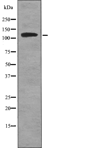 ATP1A1 (Phospho-Tyr260) Antibody