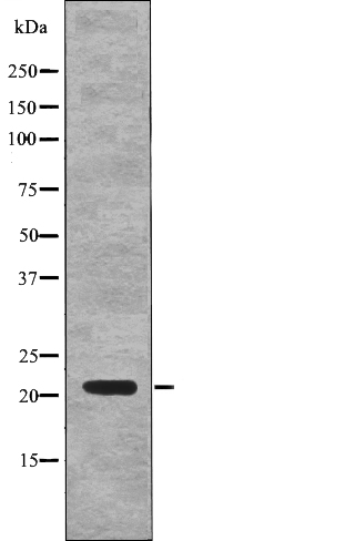 p21Cip1 (Phospho-Thr57) Antibody - Absci