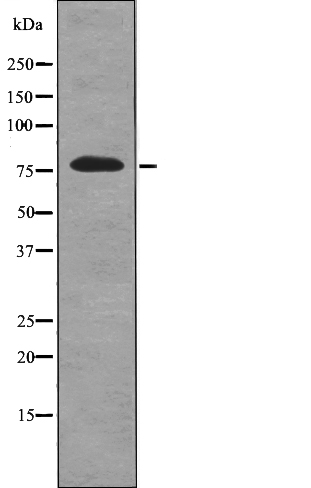 RSK2 (Phospho-Tyr529) Antibody - Absci