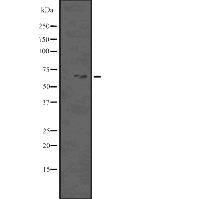 Beclin-1 (Phospho-Ser93/96) Antibody - Absci