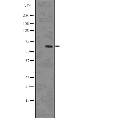 SQSTM1/p62 (Phospho-Ser403) Antibody