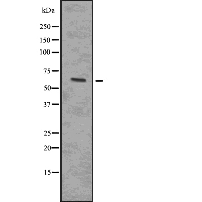 IRAK4 (Phospho-Thr345/Ser346) Antibody - Absci