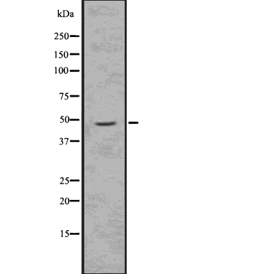 Doublecortin (Phospho-Ser334) Antibody - Absci