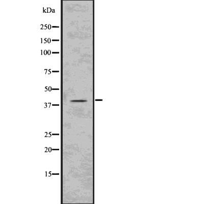 PKA C (Phospho-Thr197) Antibody - Absci