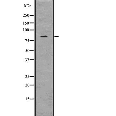 EZH2 (Phospho-Thr487) Antibody