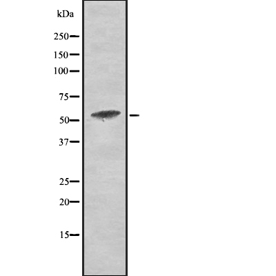 PKM2 (Phospho-Tyr105)  Antibody - Absci