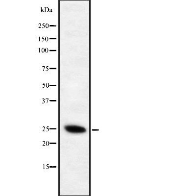 CD28 (Phospho-Tyr218) Antibody - Absci