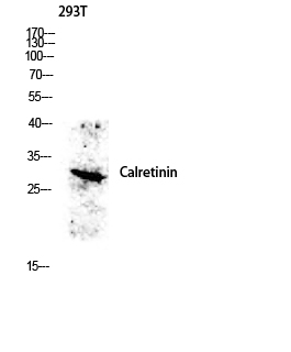 Calretinin Polyclonal Antibody